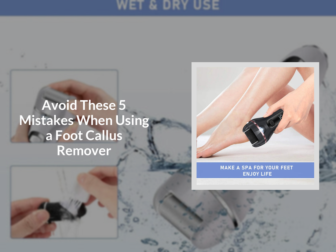 Avoid These 5 Mistakes When Using a Foot Callus Remover