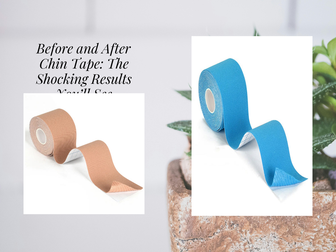 Before and After Chin Tape: The Shocking Results You’ll See