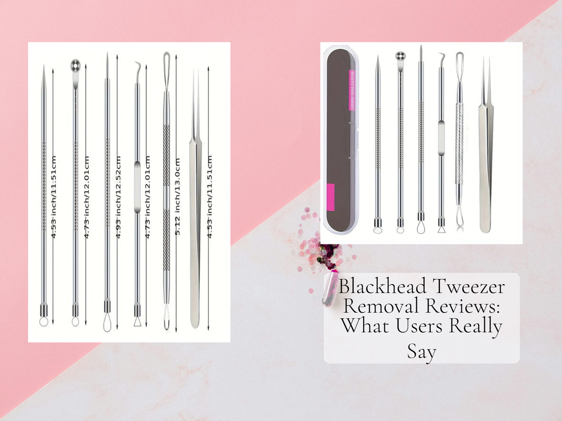 Blackhead Tweezer Removal Reviews: What Users Really Say