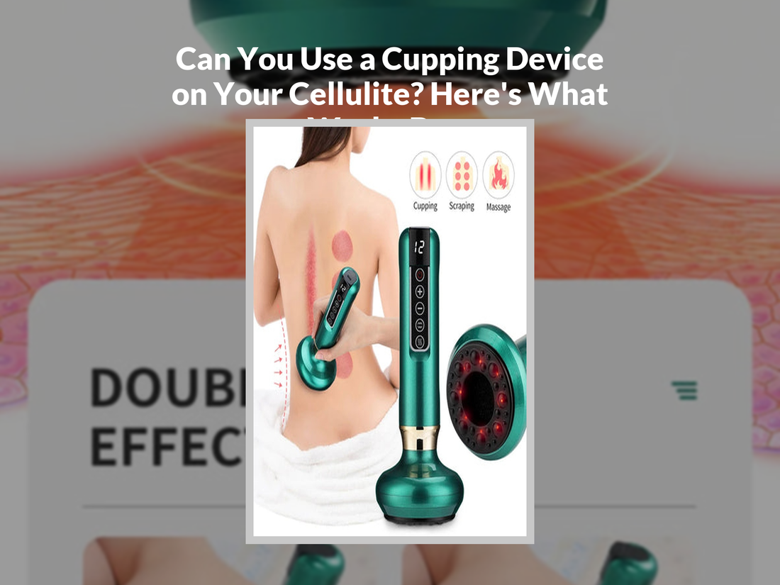 Can You Use a Cupping Device on Your Cellulite? Here's What Works Best