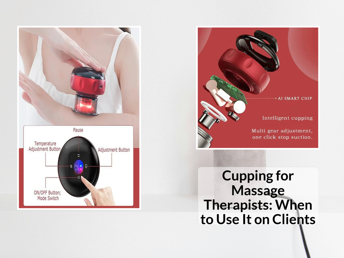 Cupping for Massage Therapists: When to Use It on Clients