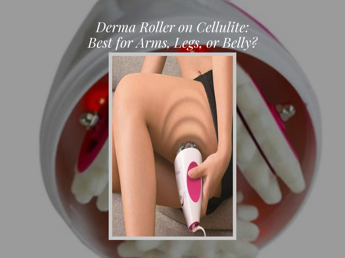 Derma Roller on Cellulite: Best for Arms, Legs, or Belly?