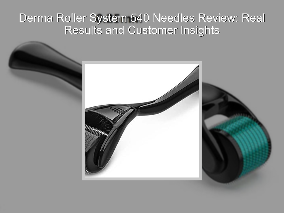 Derma Roller System 540 Needles Review: Real Results and Customer Insights