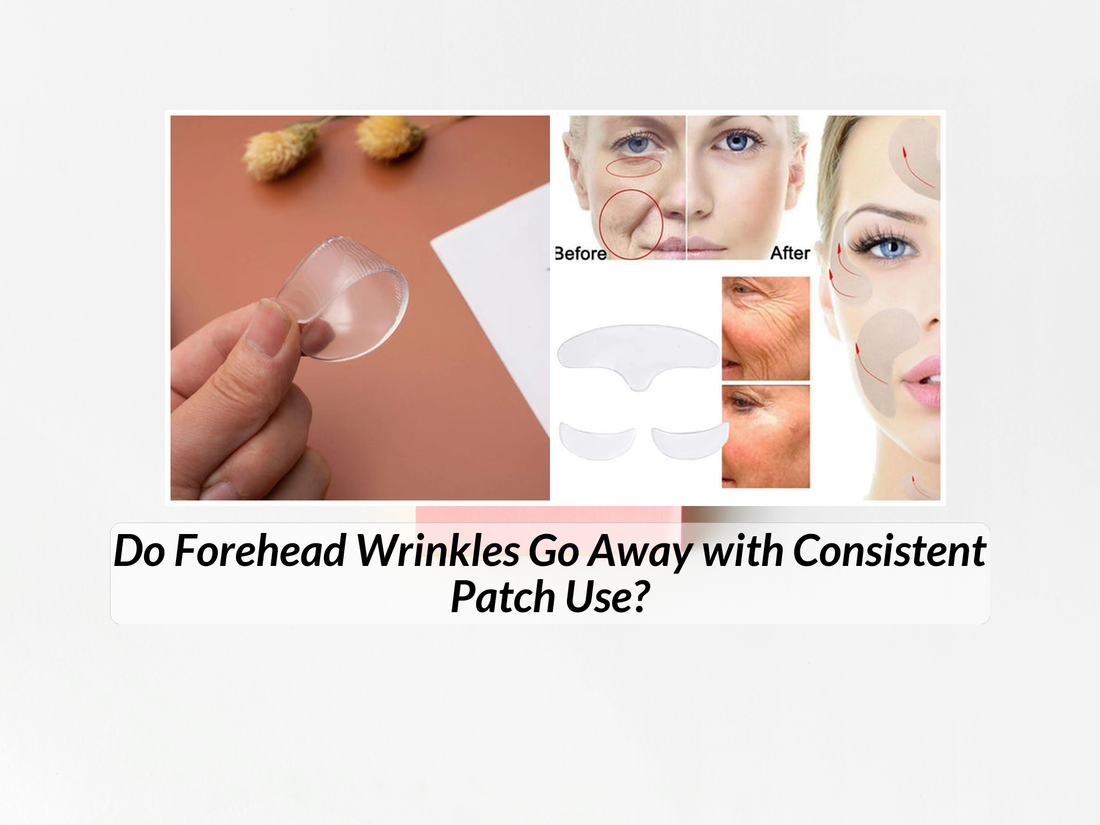 Do Forehead Wrinkles Go Away with Consistent Patch Use?