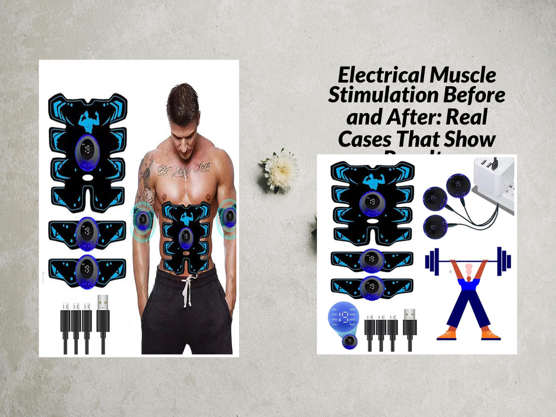 Electrical Muscle Stimulation Before and After: Real Cases That Show Results