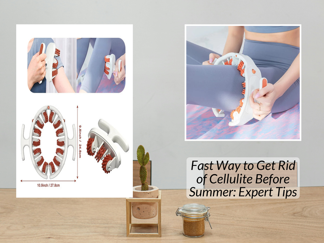 Fast Way to Get Rid of Cellulite Before Summer: Expert Tips