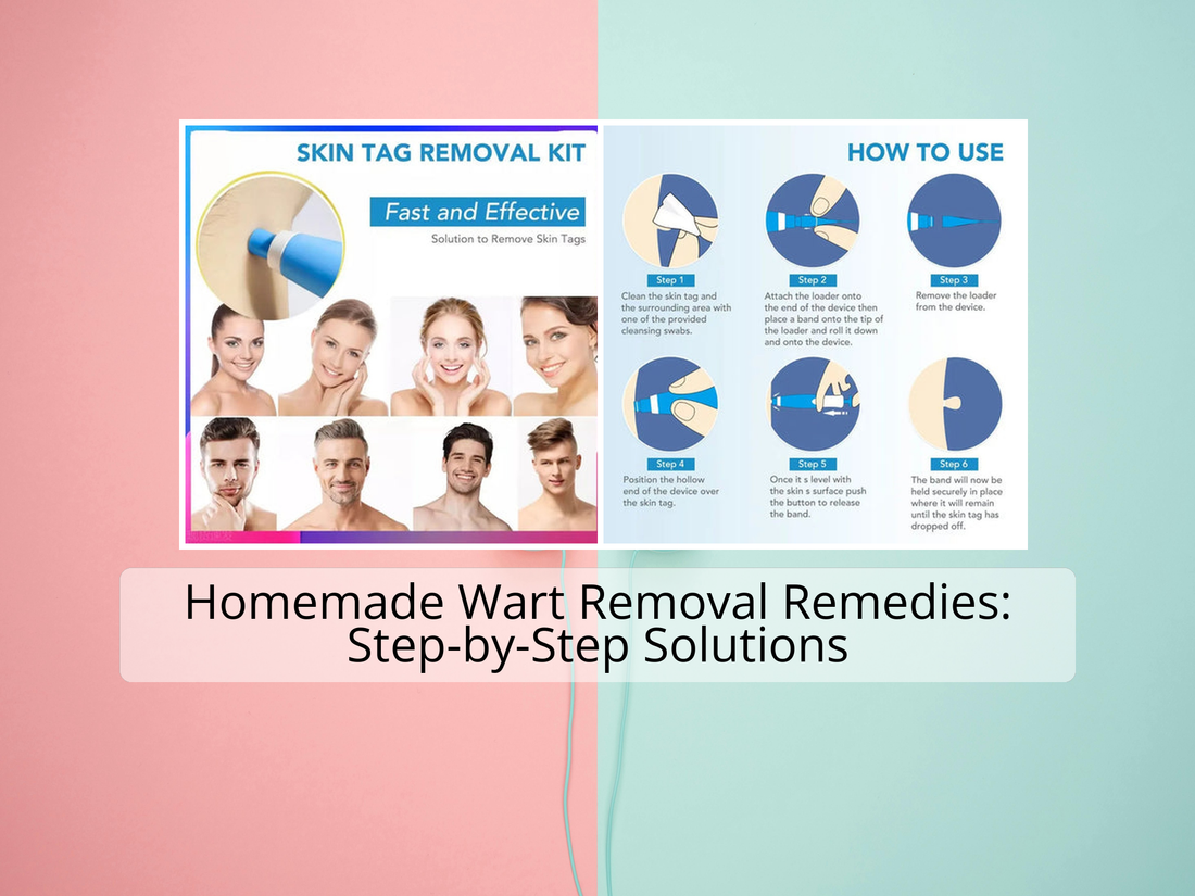 Homemade Wart Removal Remedies: Step-by-Step Solutions