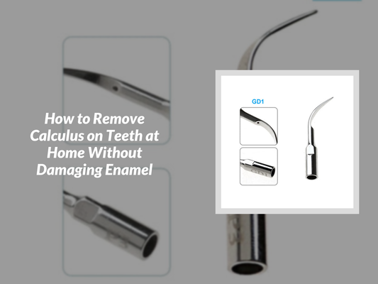How to Remove Calculus on Teeth at Home Without Damaging Enamel