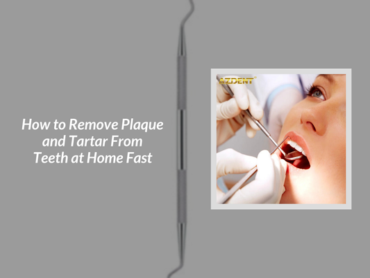 How to Remove Plaque and Tartar From Teeth at Home Fast