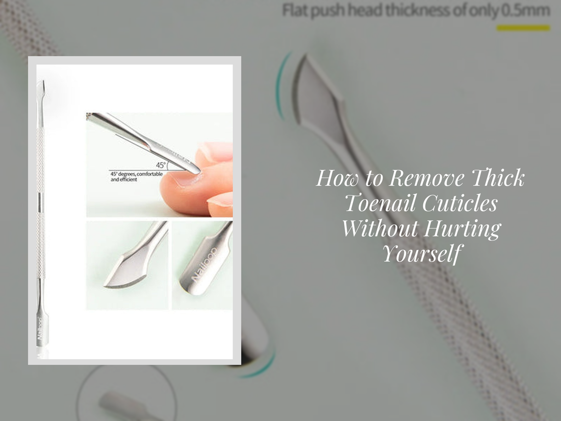 How to Remove Thick Toenail Cuticles Without Hurting Yourself