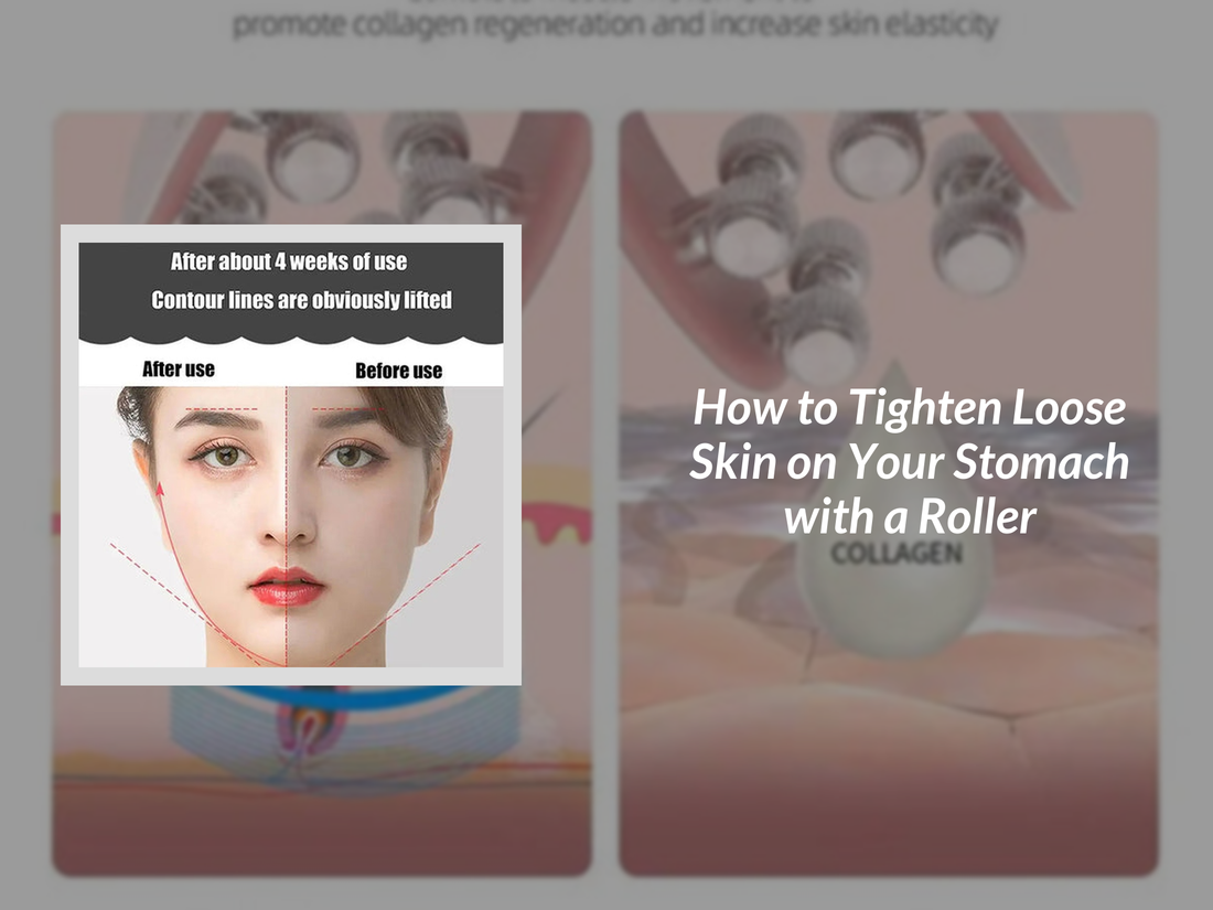 How to Tighten Loose Skin on Your Stomach with a Roller