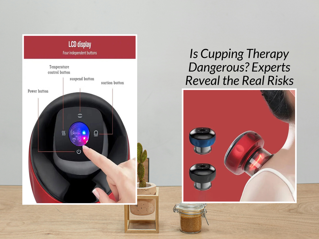 Is Cupping Therapy Dangerous? Experts Reveal the Real Risks