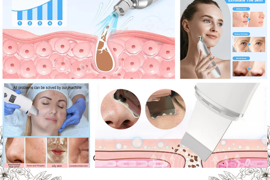 Can Microdermabrasion Help With Age Spots