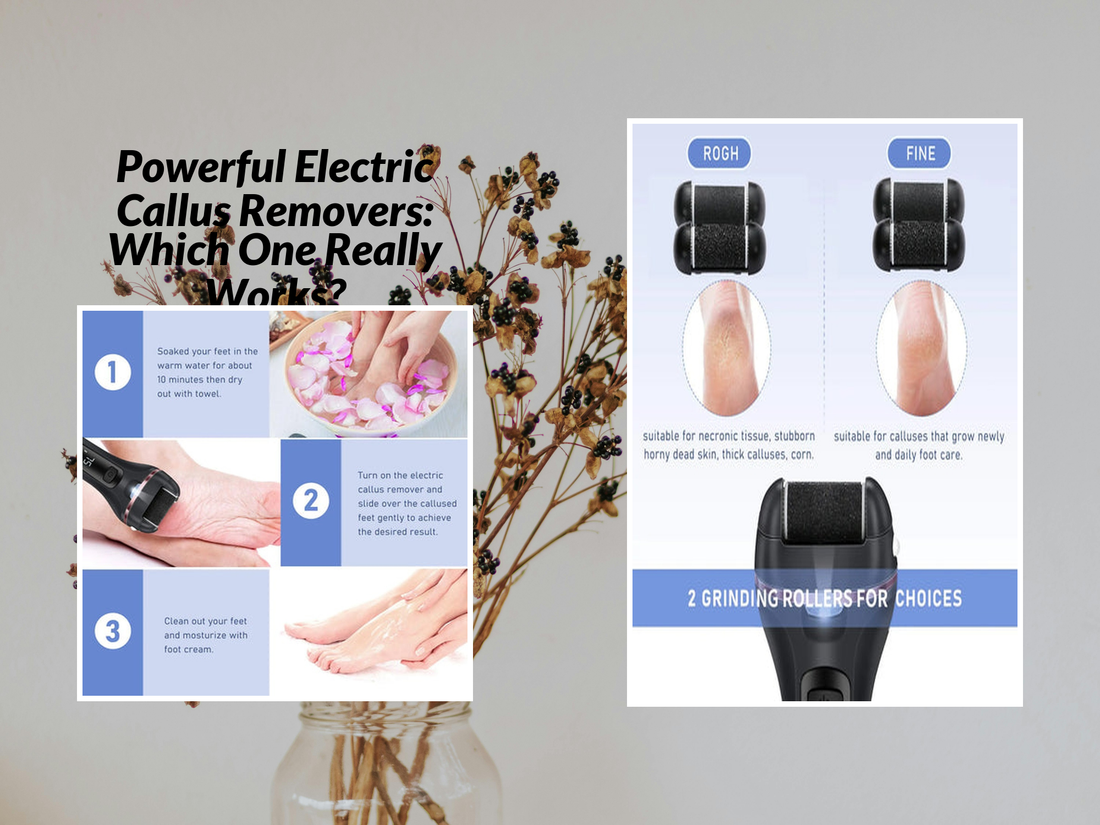 Powerful Electric Callus Removers: Which One Really Works?