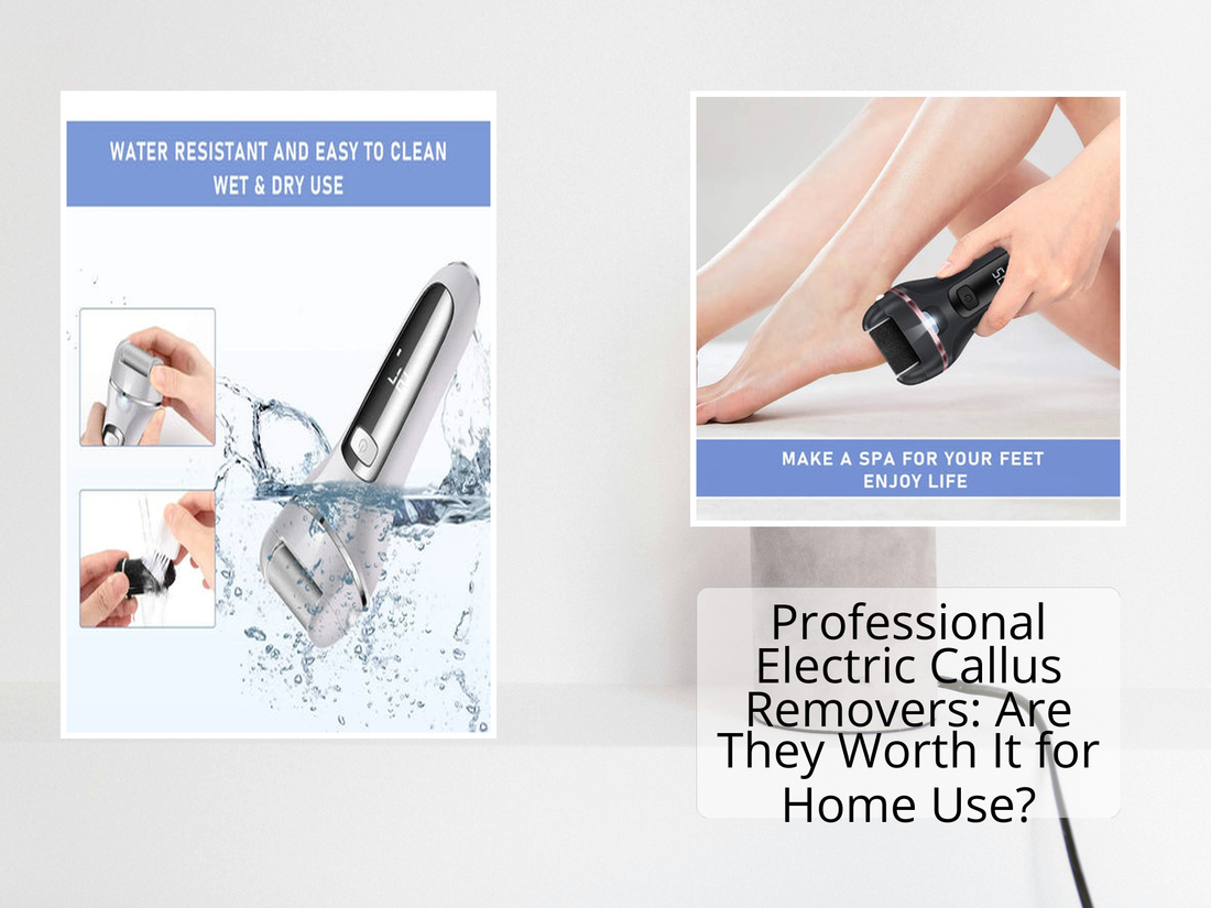 Professional Electric Callus Removers: Are They Worth It for Home Use?