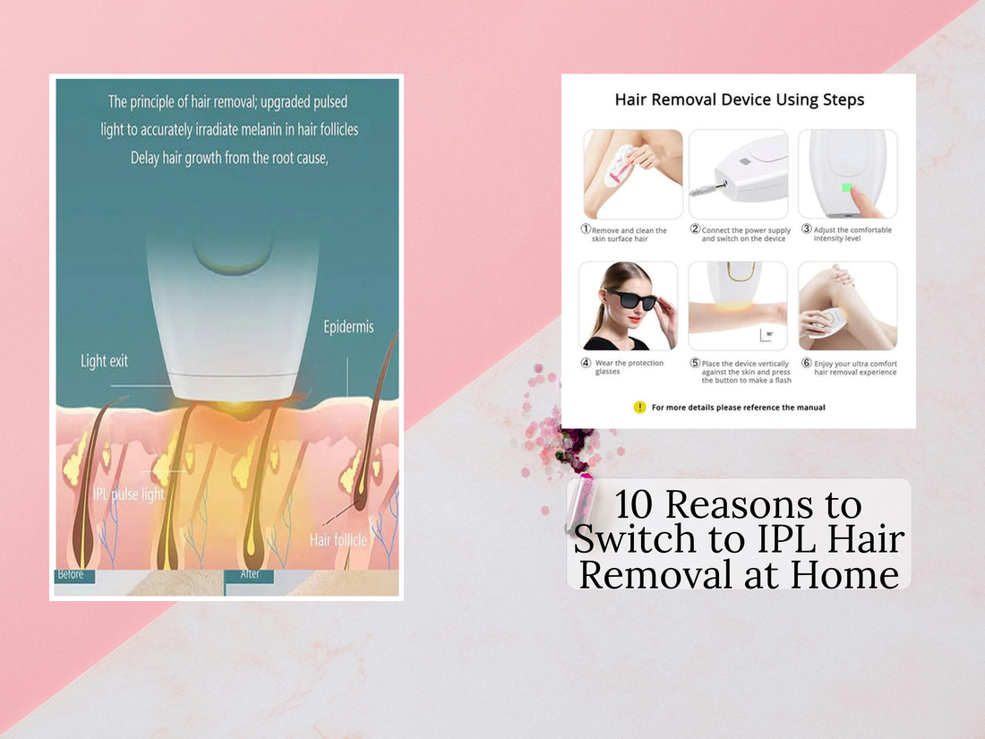 10 Reasons to Switch to IPL Hair Removal at Home