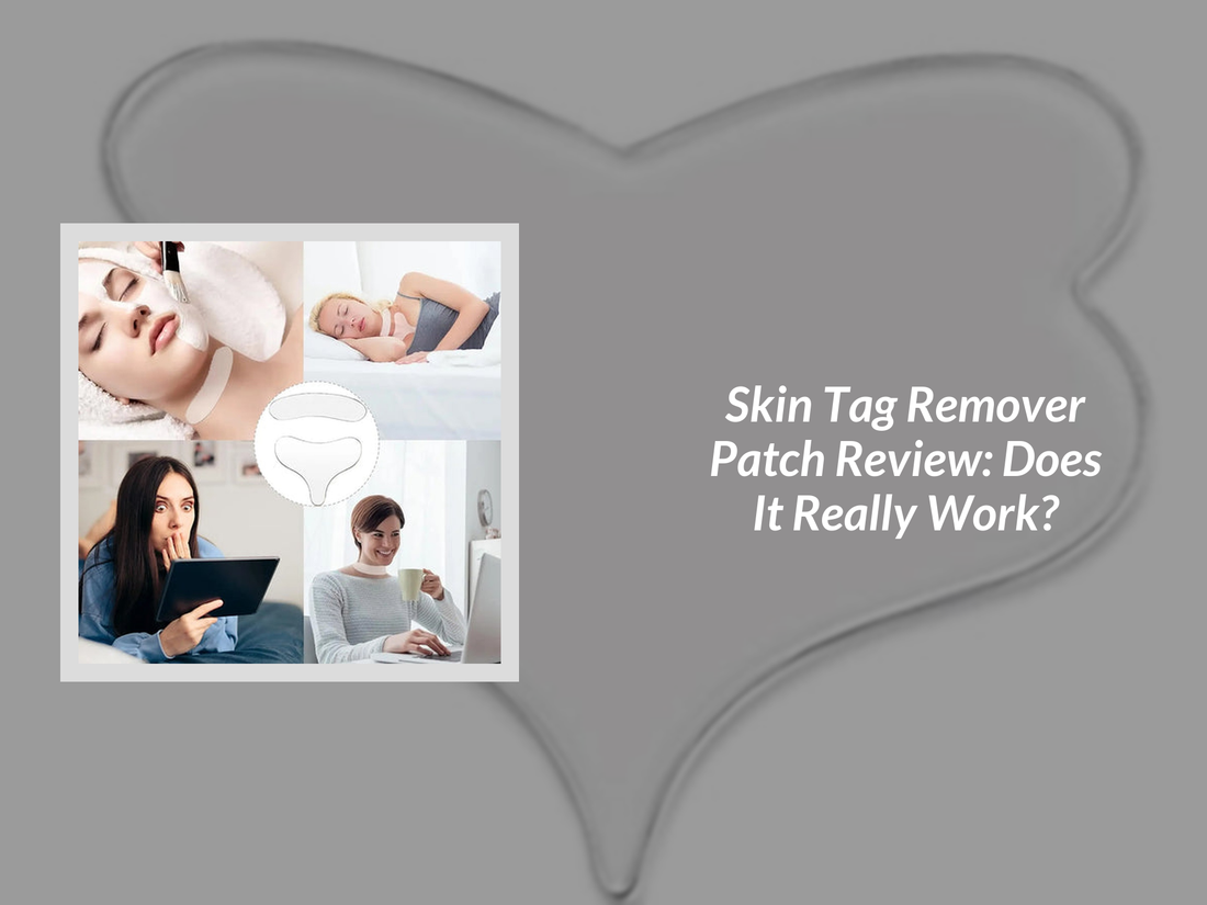 Skin Tag Remover Patch Review: Does It Really Work?