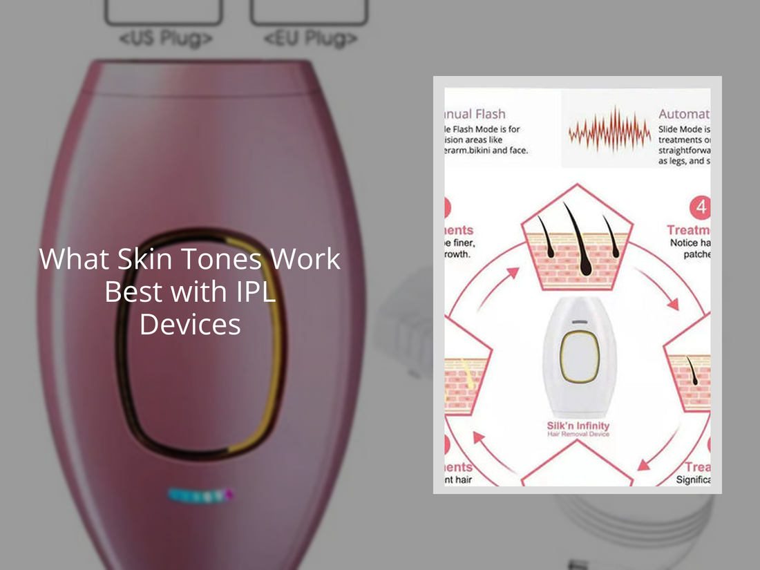 What Skin Tones Work Best with IPL Devices