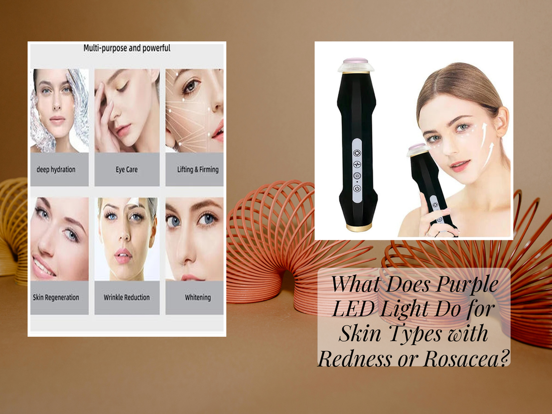What Does Purple LED Light Do for Skin Types with Redness or Rosacea?