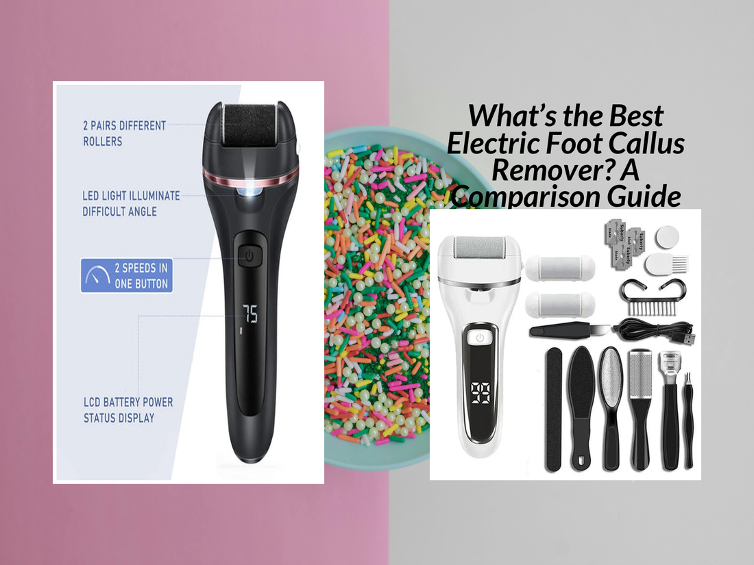 What’s the Best Electric Foot Callus Remover? A Comparison Guide