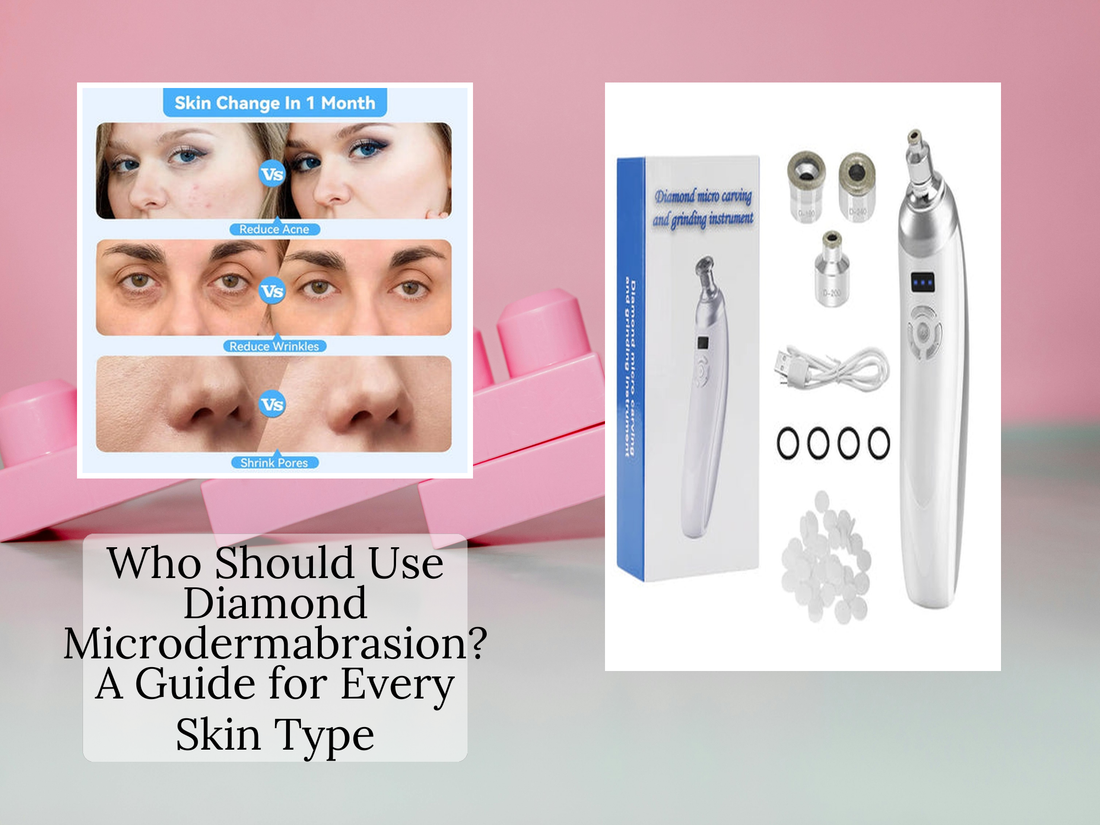 Who Should Use Diamond Microdermabrasion? A Guide for Every Skin Type