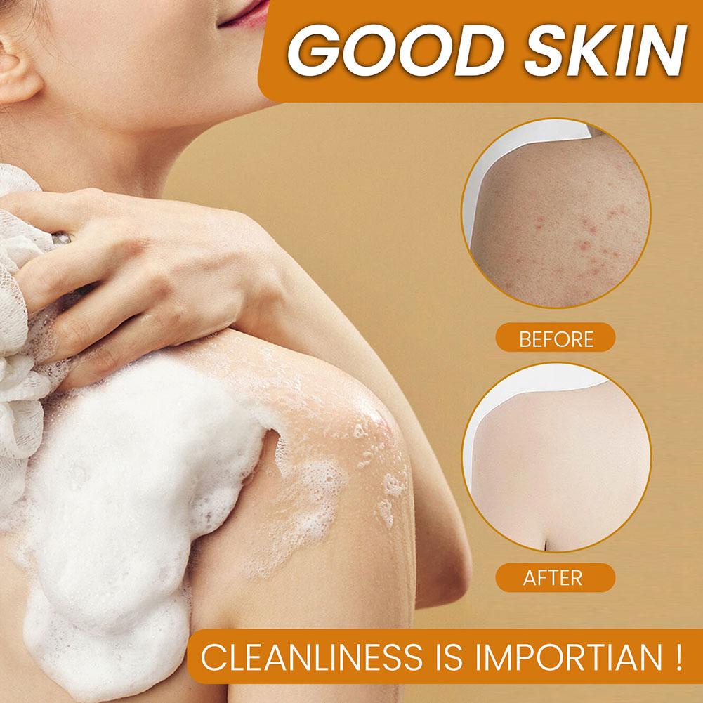 KentDO™ Turmeric Kojic Acid Soap – Brightening & Clear Skin