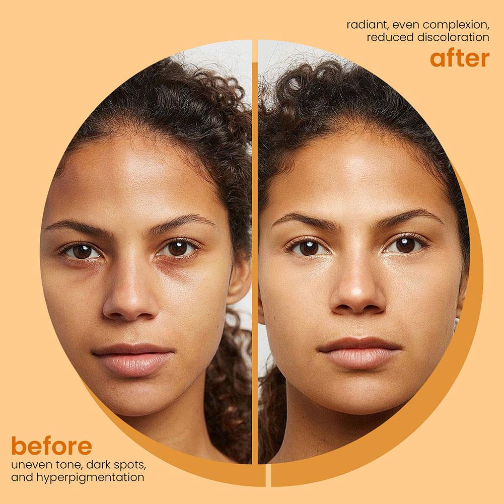 KentDO™ Turmeric Kojic Acid Soap – Brightening & Clear Skin