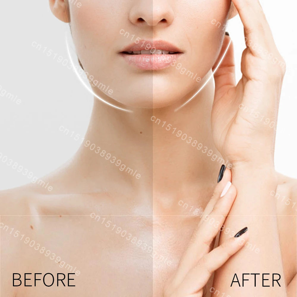 KentDO™ Face Lifting Patches – Instant Anti-Wrinkle Solution