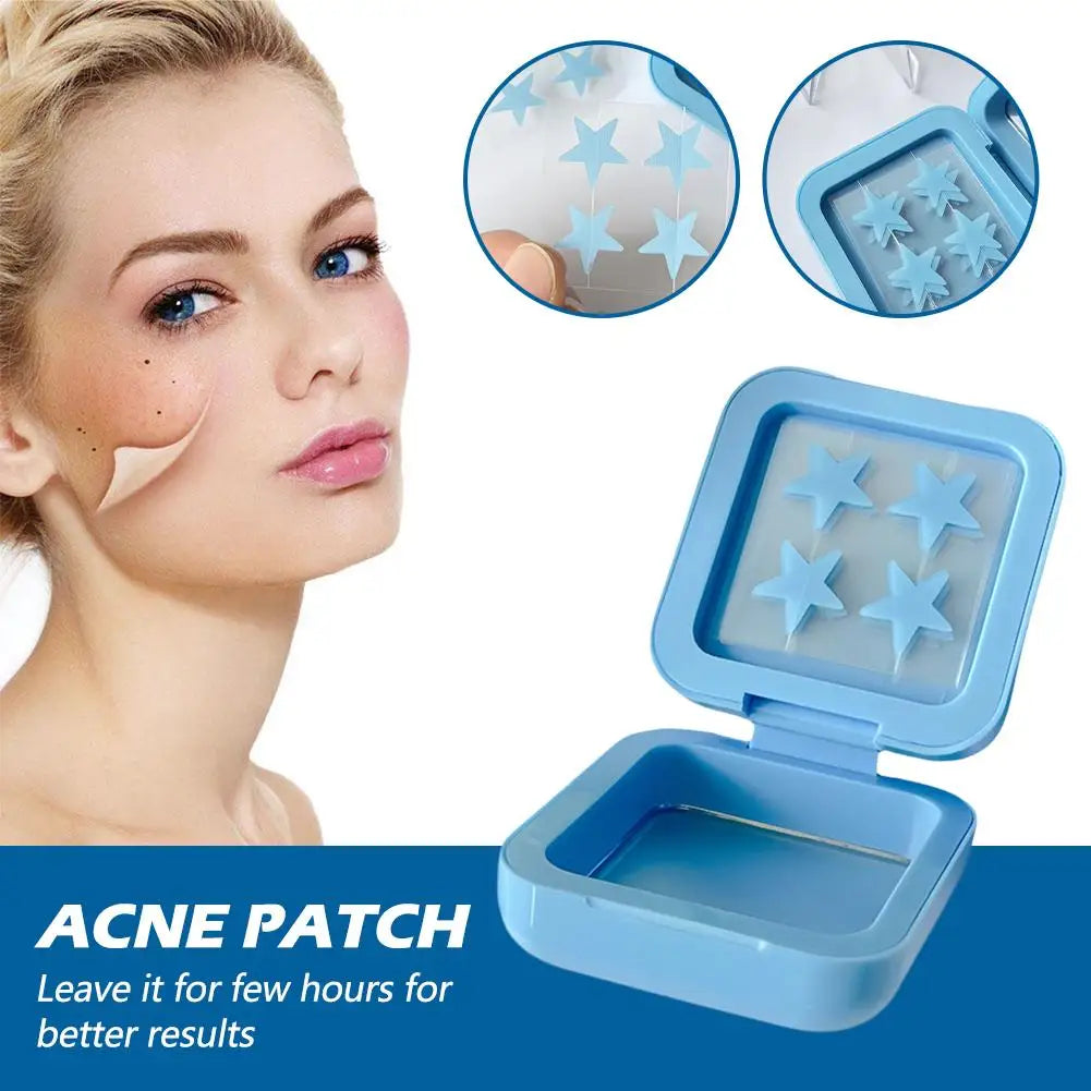 KentDO™ Hydrocolloid Acne Patches – Fast Spot Healing