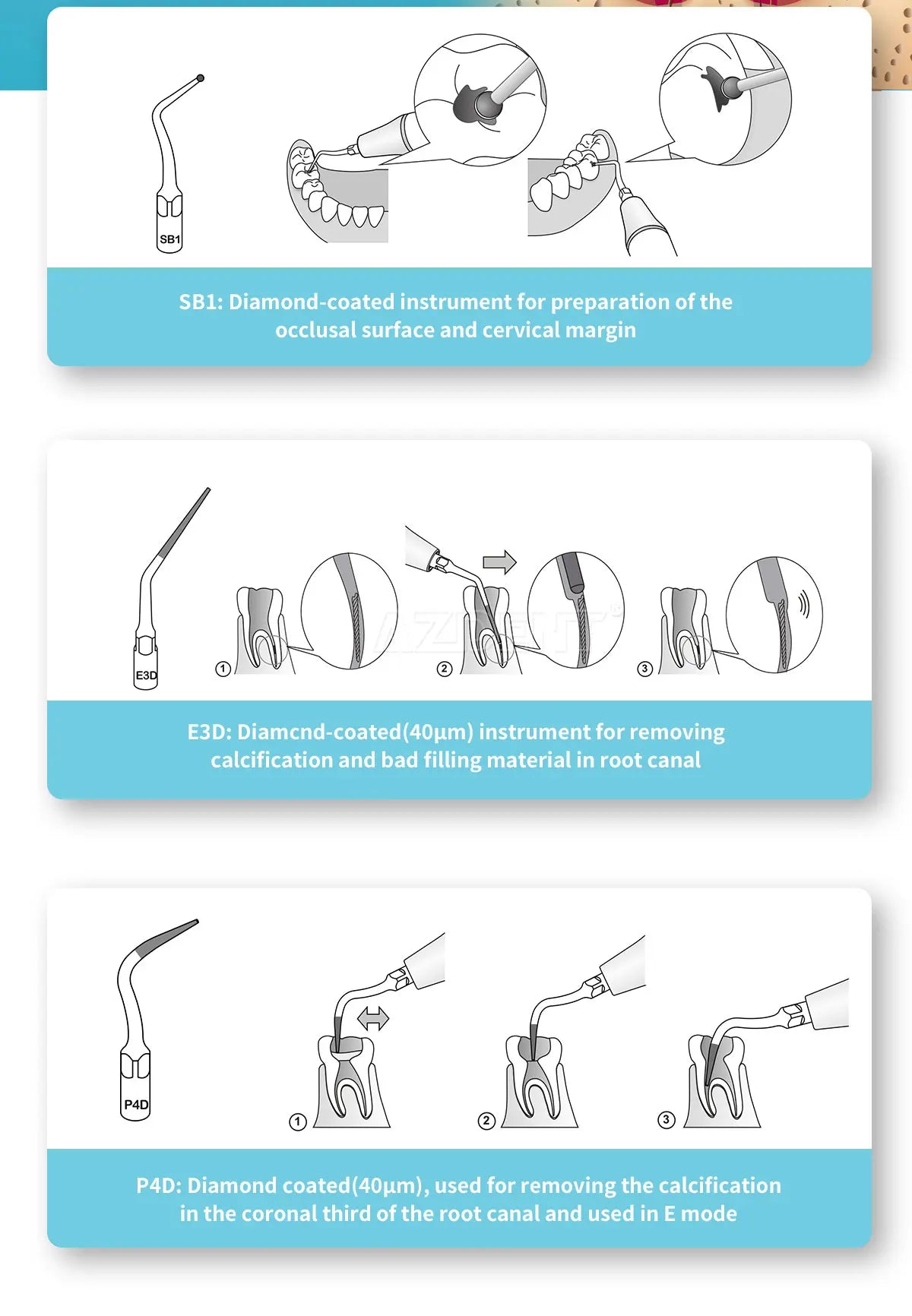 KentDO™ 5pcs Dental Ultrasonic Scaler Tips – Precision Cleaning