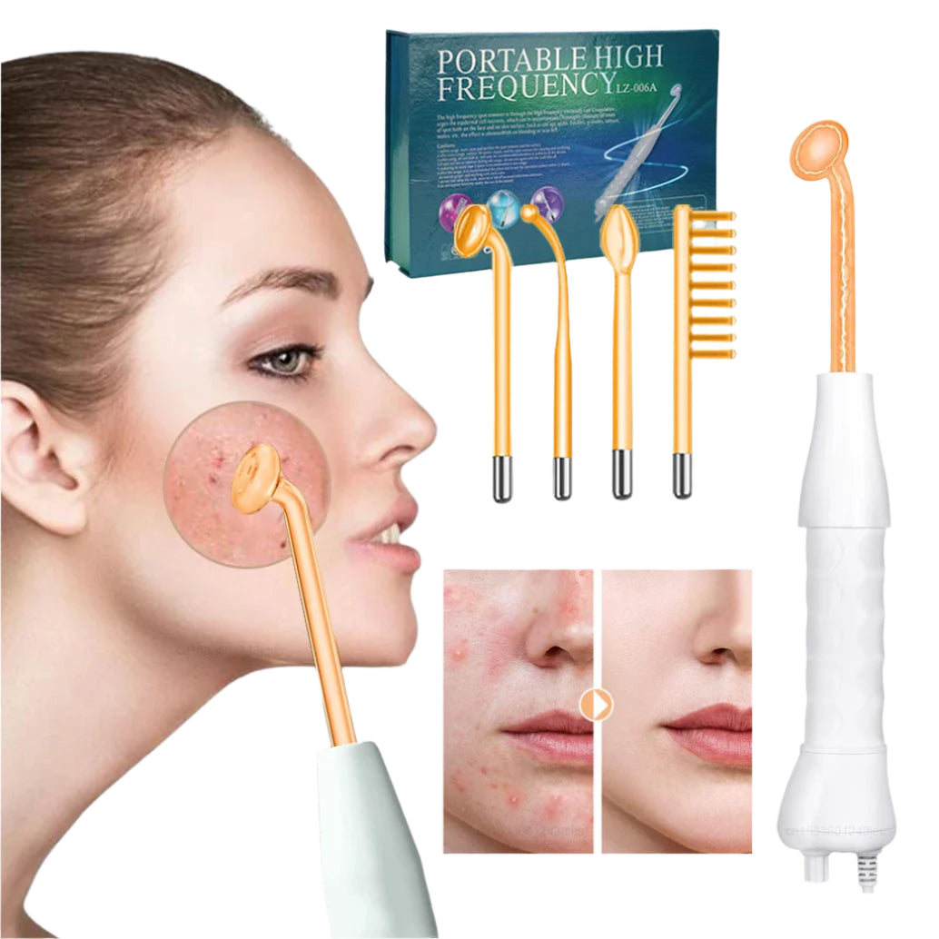 KentDO™ High Frequency Wand for Acne & Skin Tightening