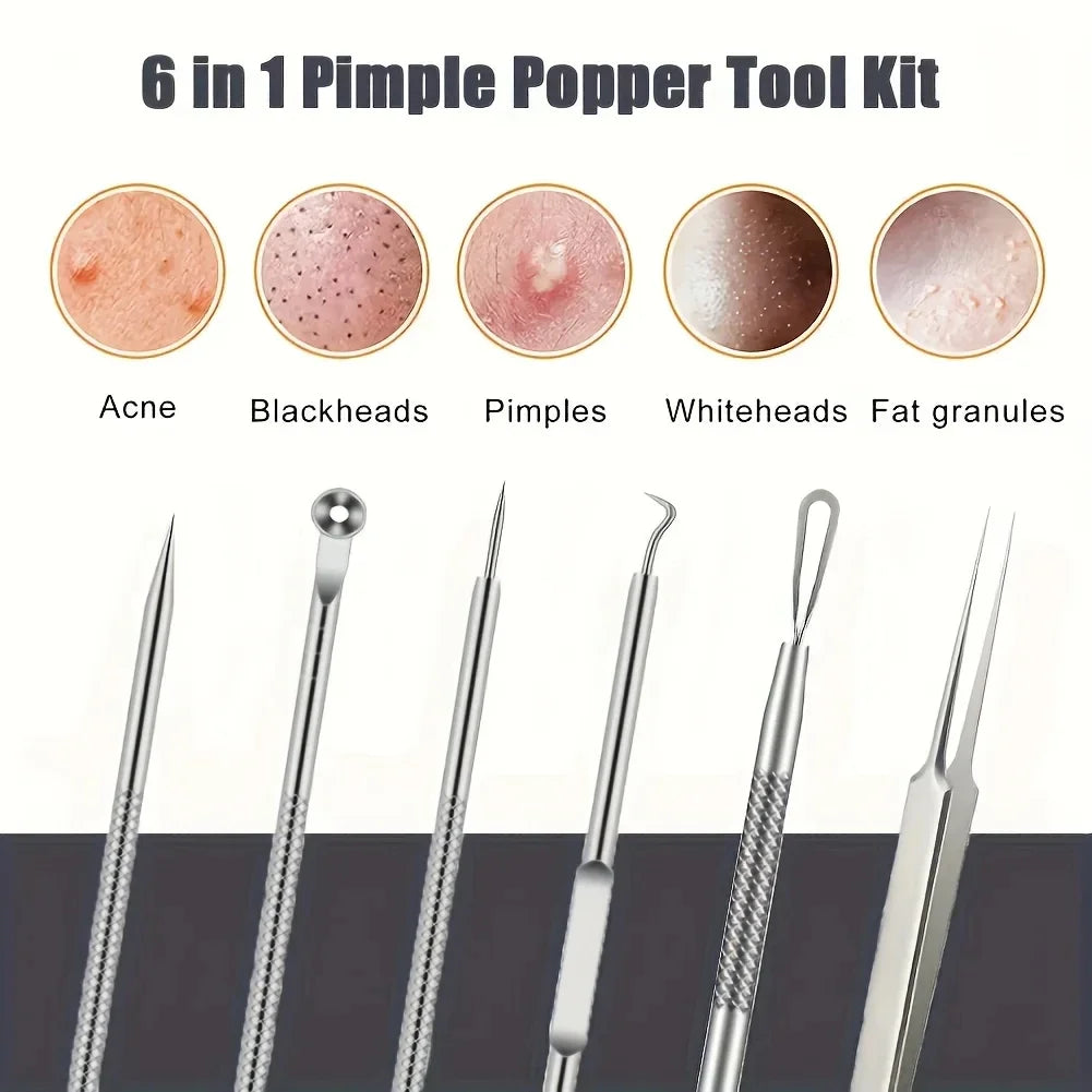 KentDO™ 6Pcs Pimple Tweezers Set – Pro Acne Care Tool