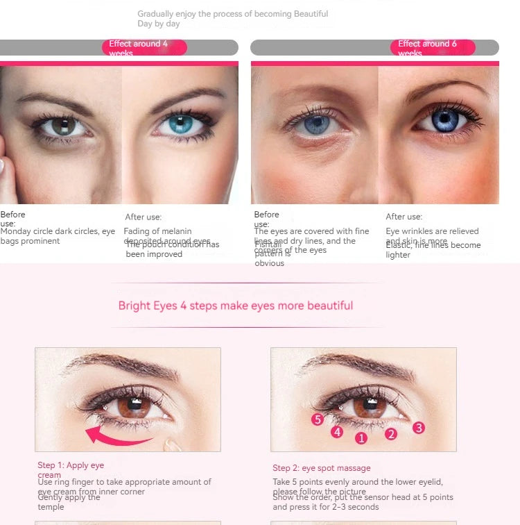 KentDO™ Electric Eye Massager – Reduce Puffiness & Fine Lines