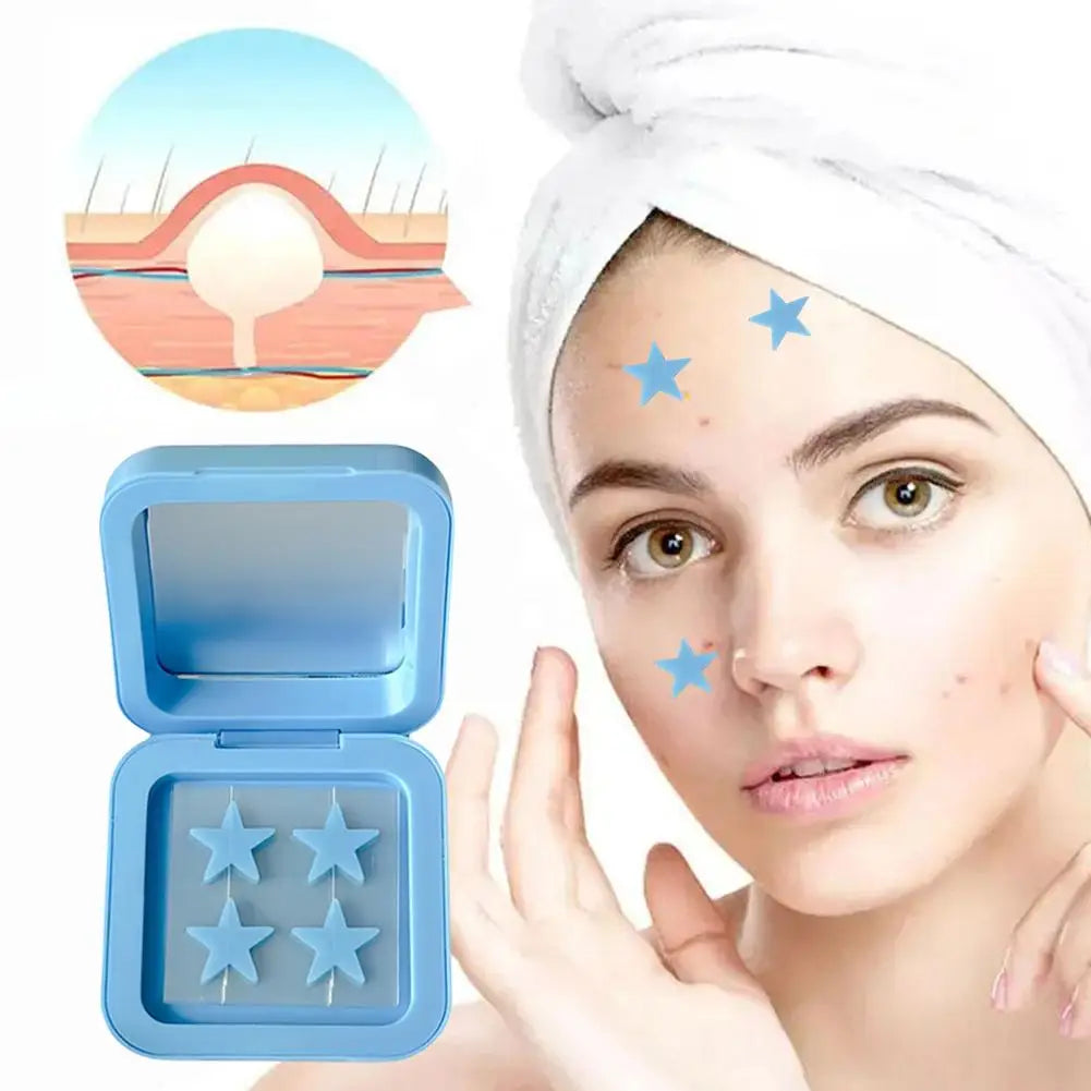 KentDO™ Hydrocolloid Acne Patches – Fast Spot Healing