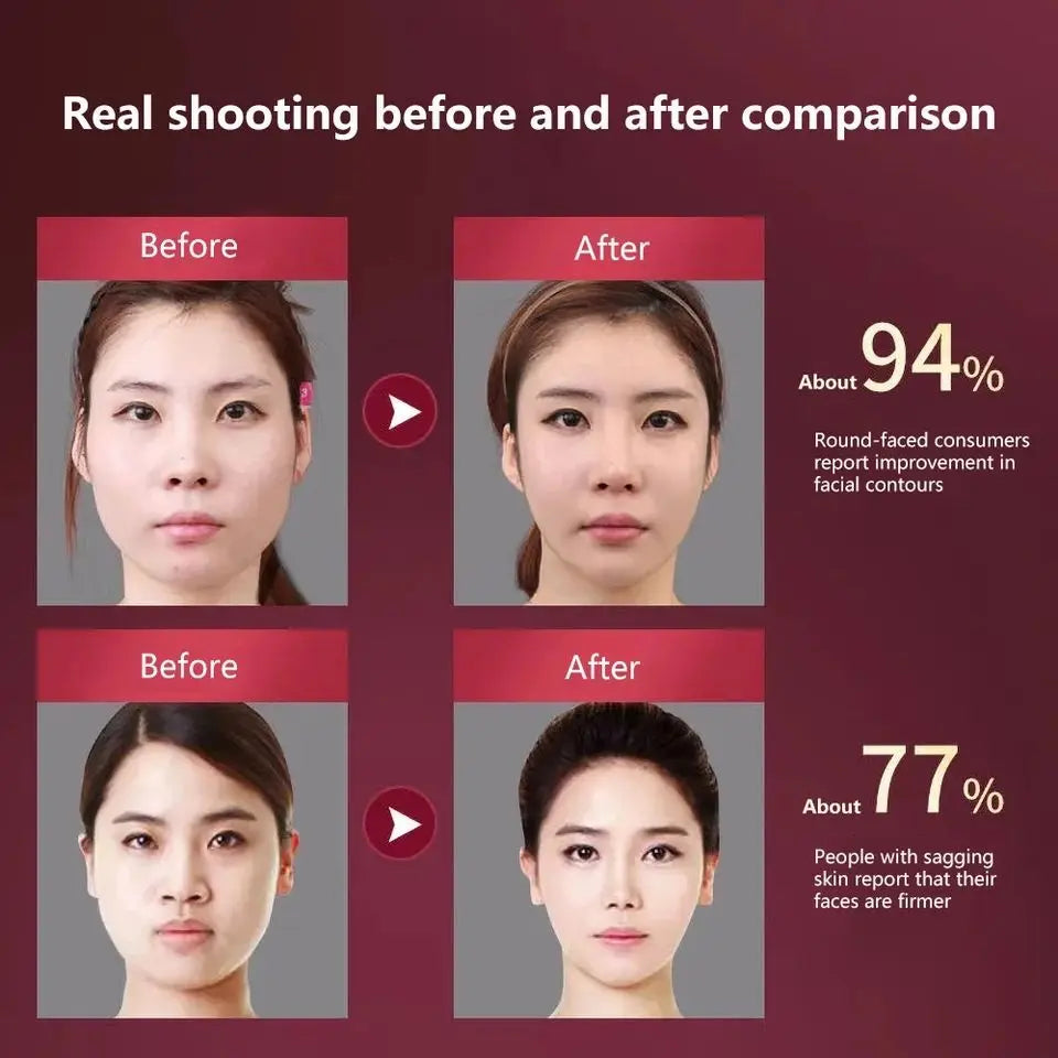 KentDO™ LED V-Face Massager – Lift, Slim & Rejuvenate Skin