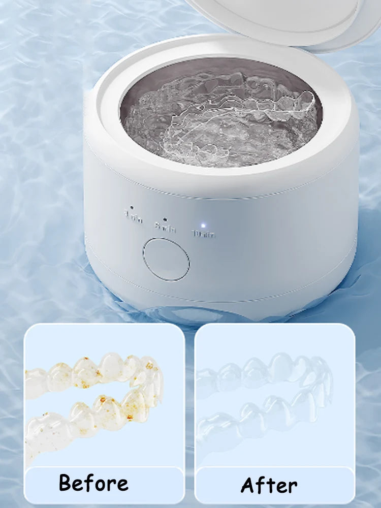KentDO™ Ultrasonic Retainer Cleaner – Deep, Safe Clean