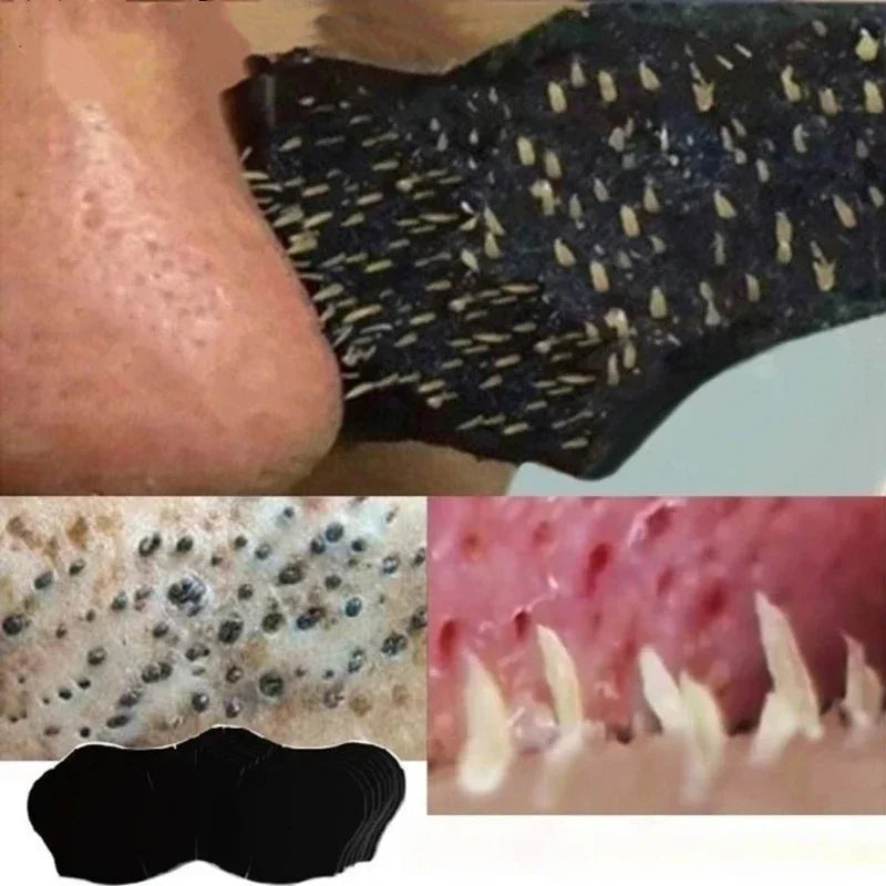 KentDO™ Blackhead Removal Nose Strips – Deep Pore Cleanse