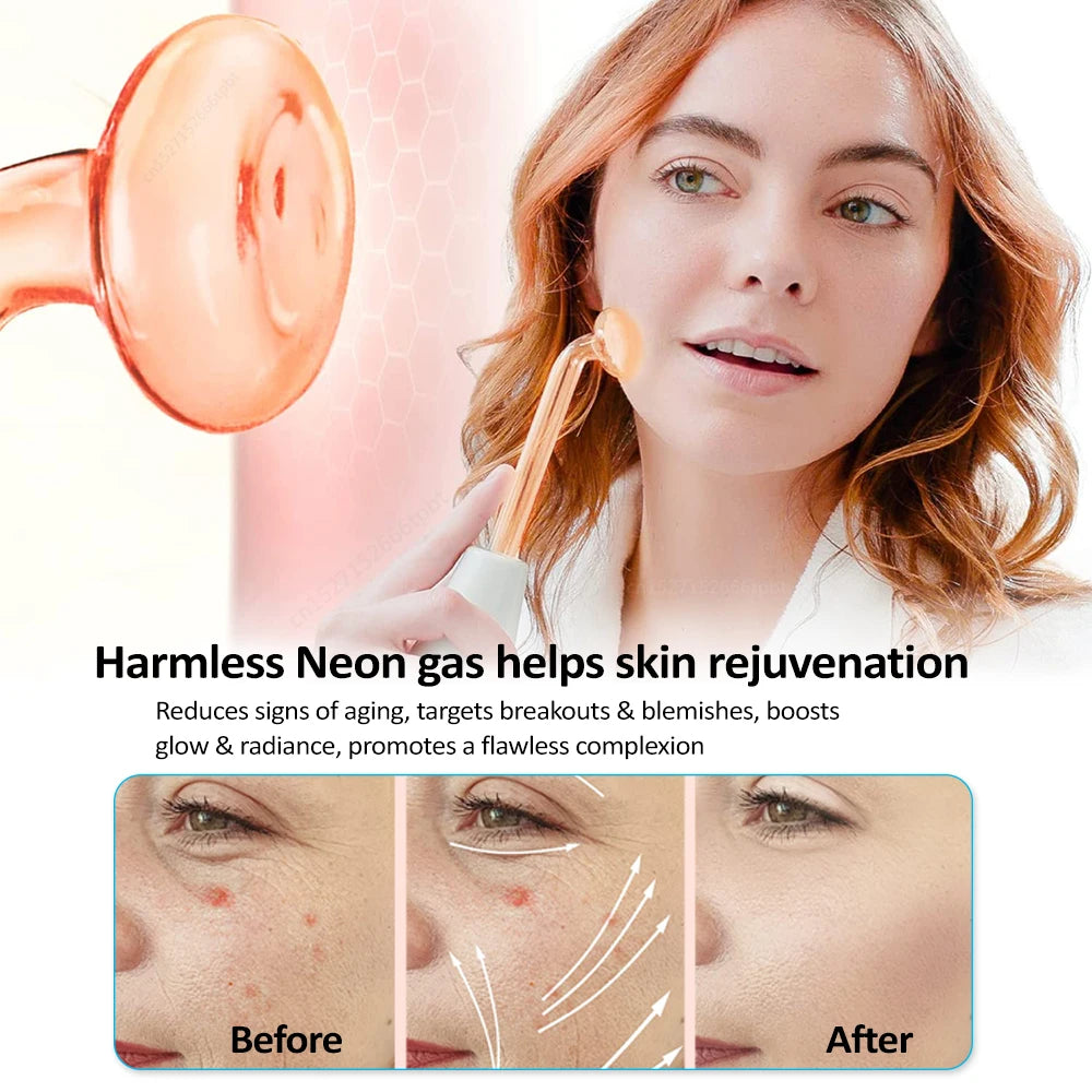 KentDO™ High Frequency Wand for Acne & Skin Tightening