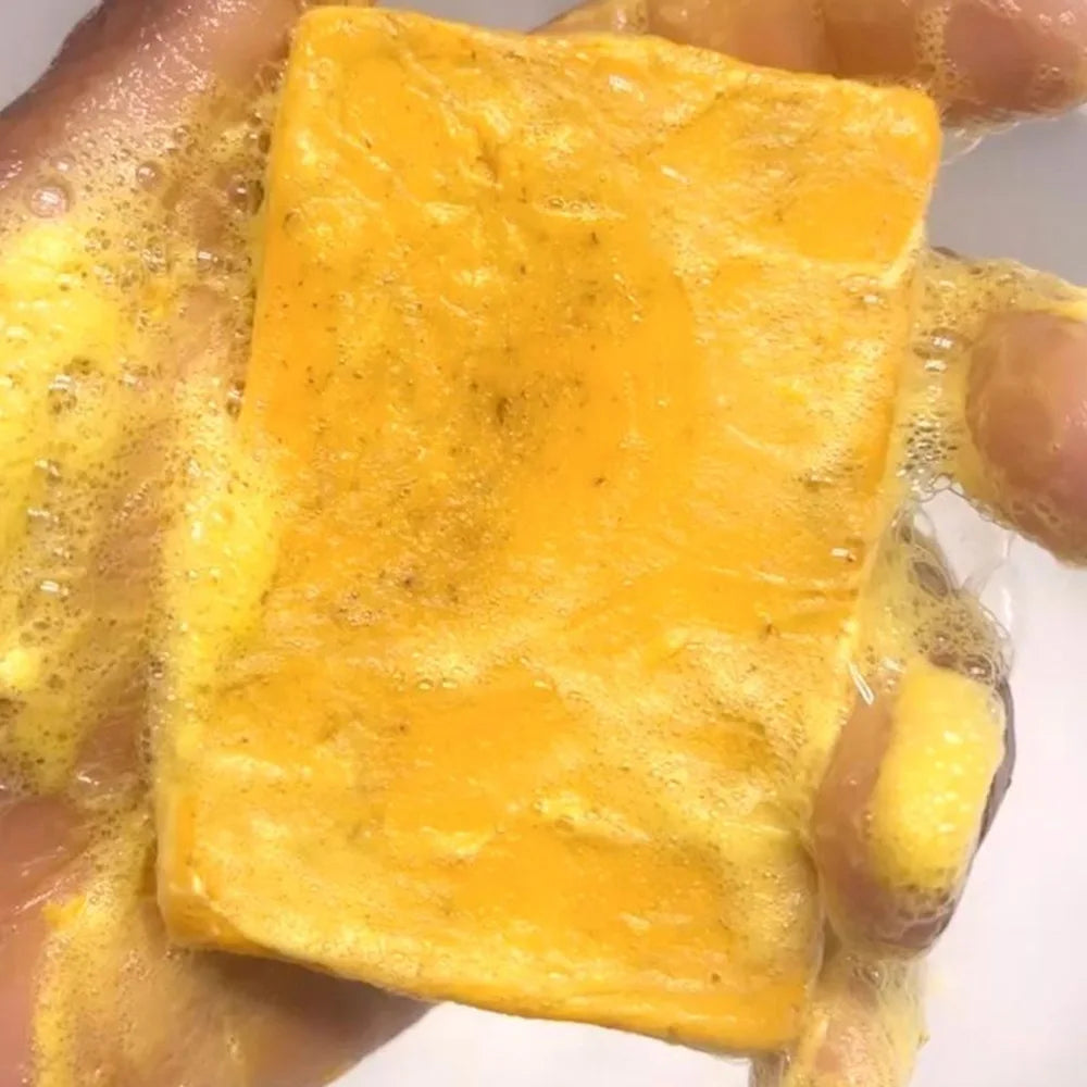 KentDO™ Turmeric Kojic Acid Soap – Brightening & Clear Skin