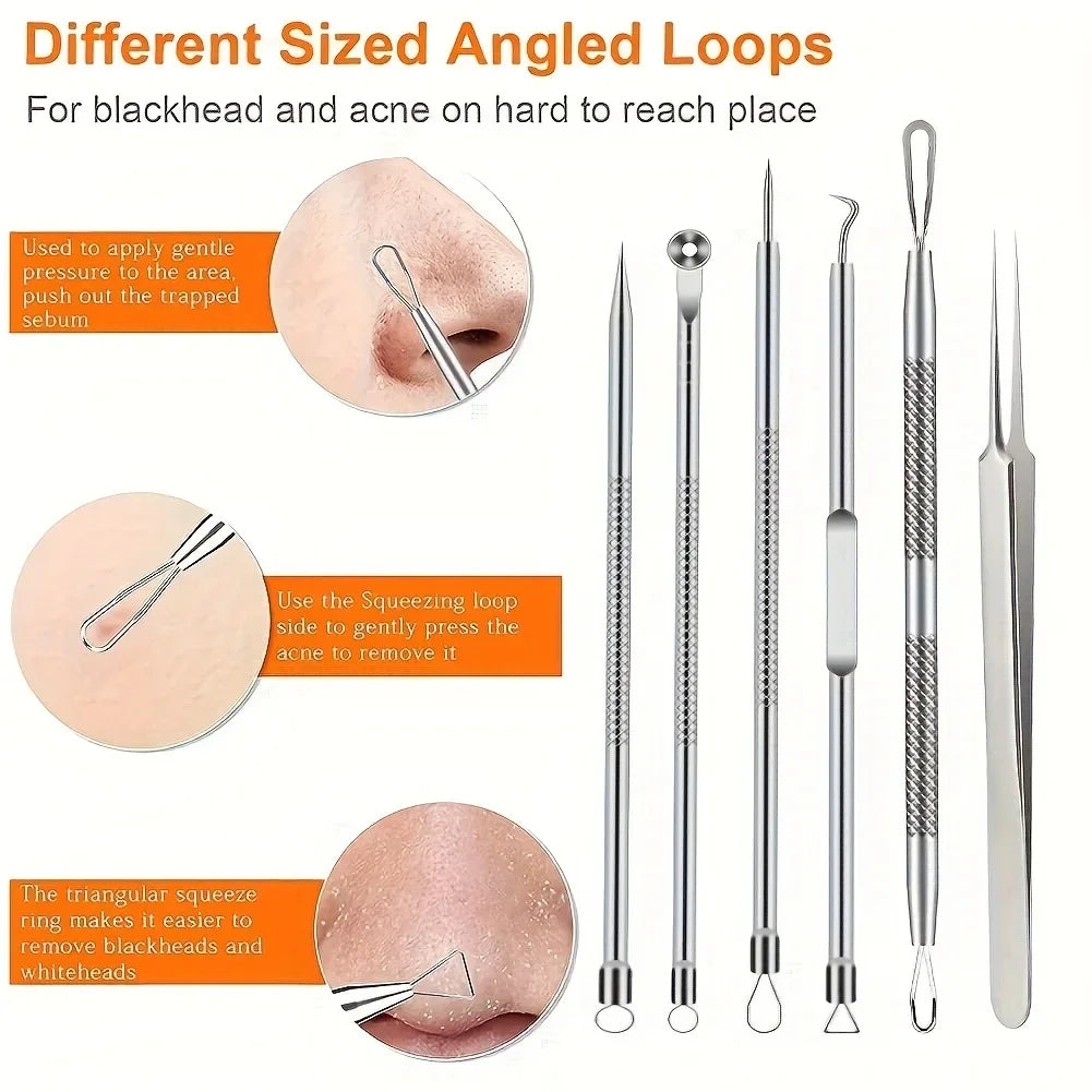 KentDO™ 6Pcs Pimple Tweezers Set – Pro Acne Care Tool