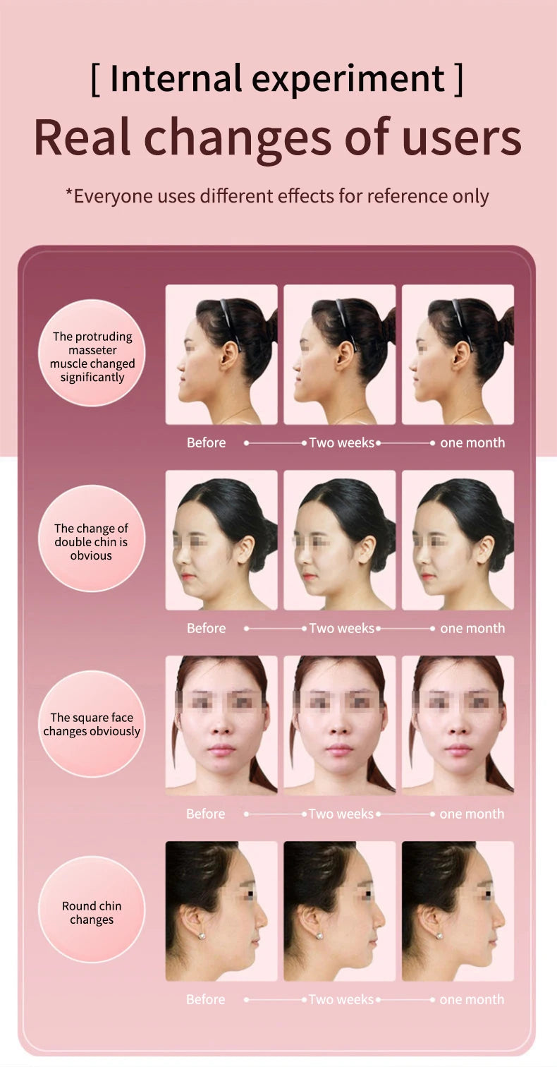 KentDO™ LED V-Face Massager – Lift, Slim & Rejuvenate Skin