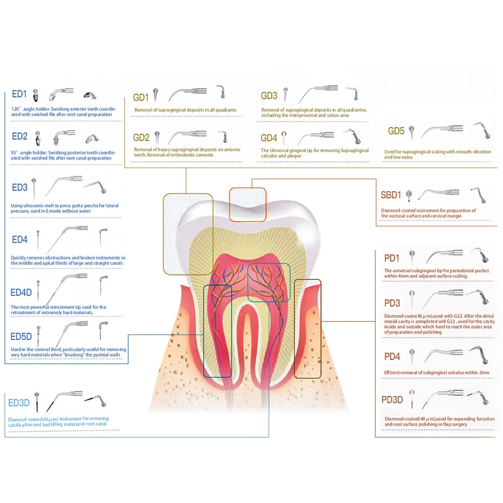 KentDO™ 5pcs Dental Ultrasonic Scaler Tips – Precision Cleaning