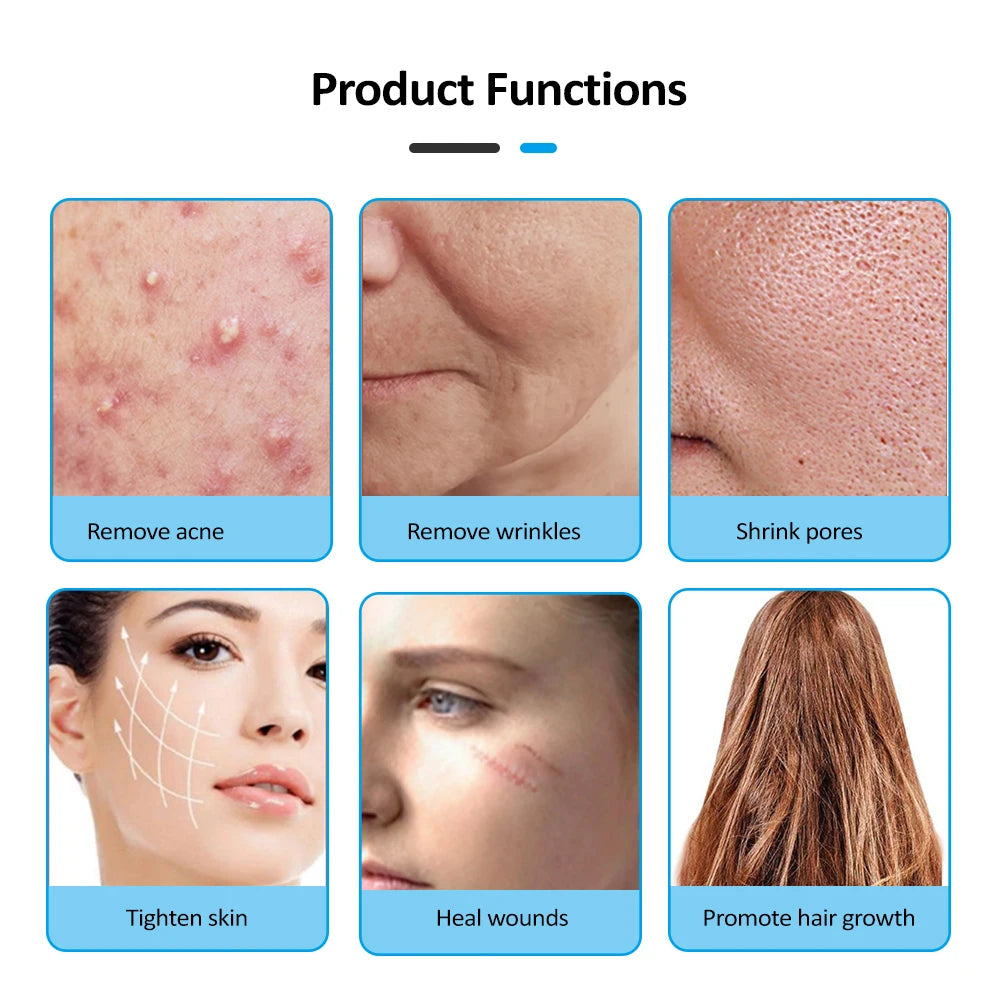 KentDO™ High Frequency Wand for Acne & Skin Tightening