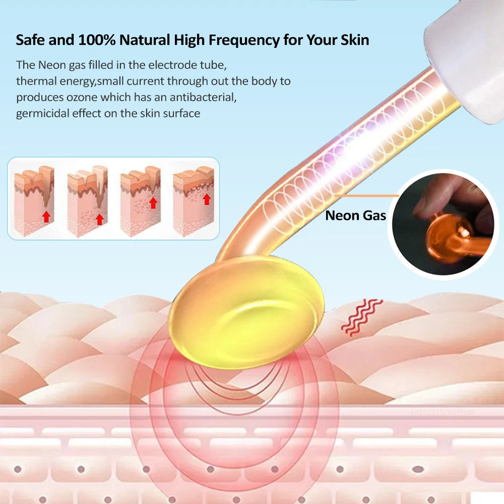 KentDO™ High Frequency Wand for Acne & Skin Tightening