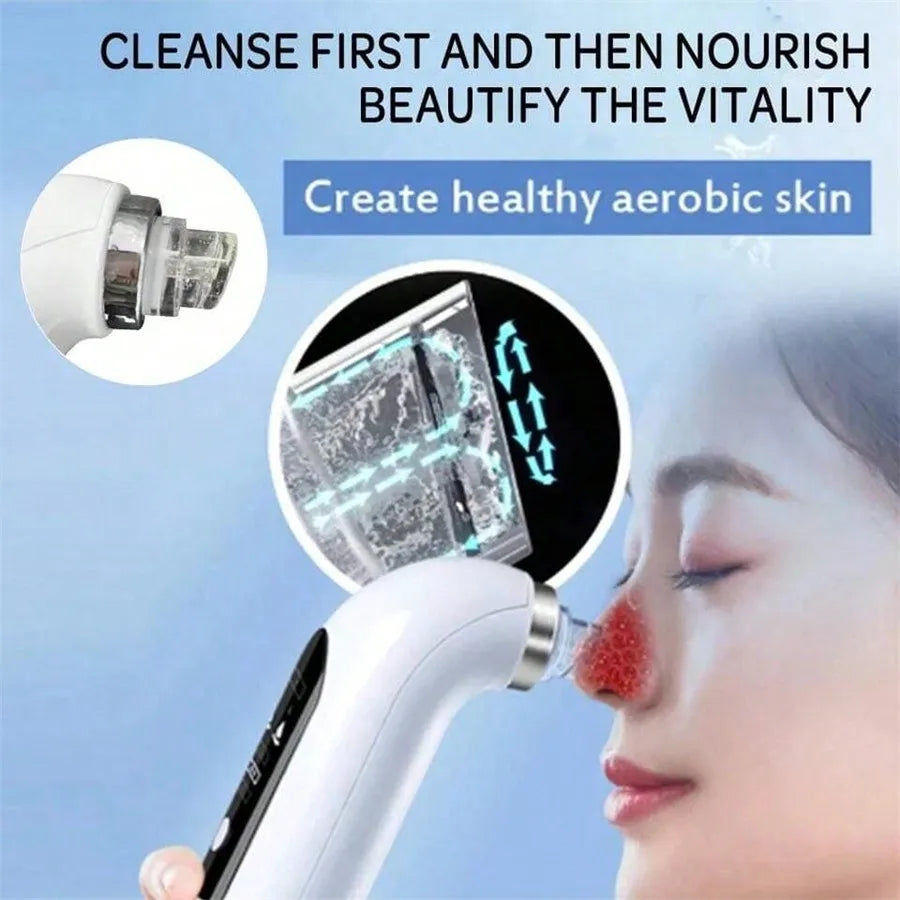 KentDO™ Pore Vacuum Blackhead Remover & Facial Cleaner