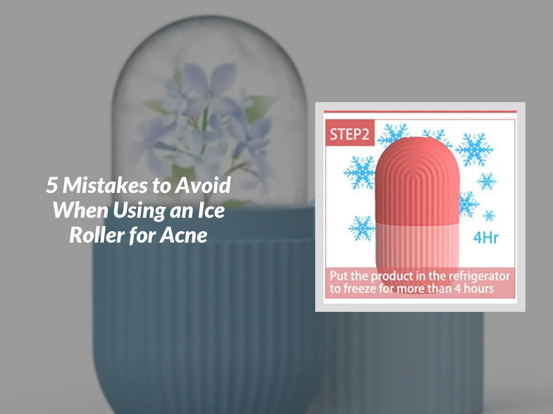 5 Mistakes to Avoid When Using an Ice Roller for Acne