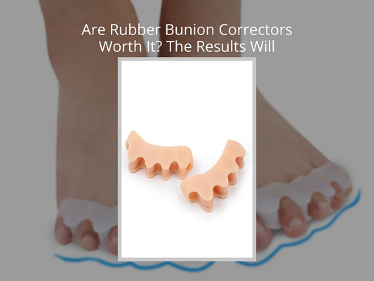 Are Rubber Bunion Correctors Worth It? The Results Will Surprise You