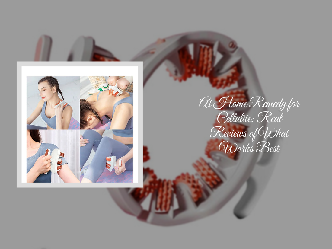 At Home Remedy for Cellulite: Real Reviews of What Works Best