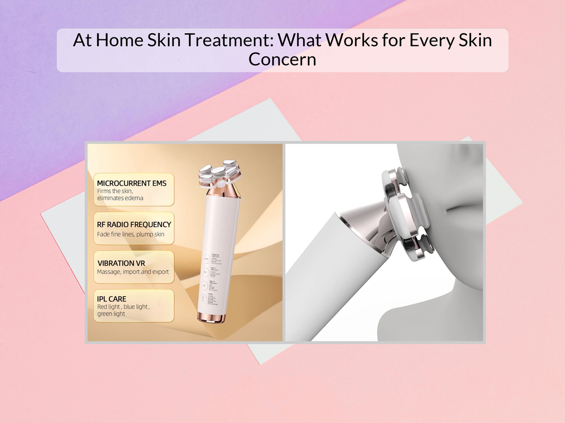 At Home Skin Treatment: What Works for Every Skin Concern