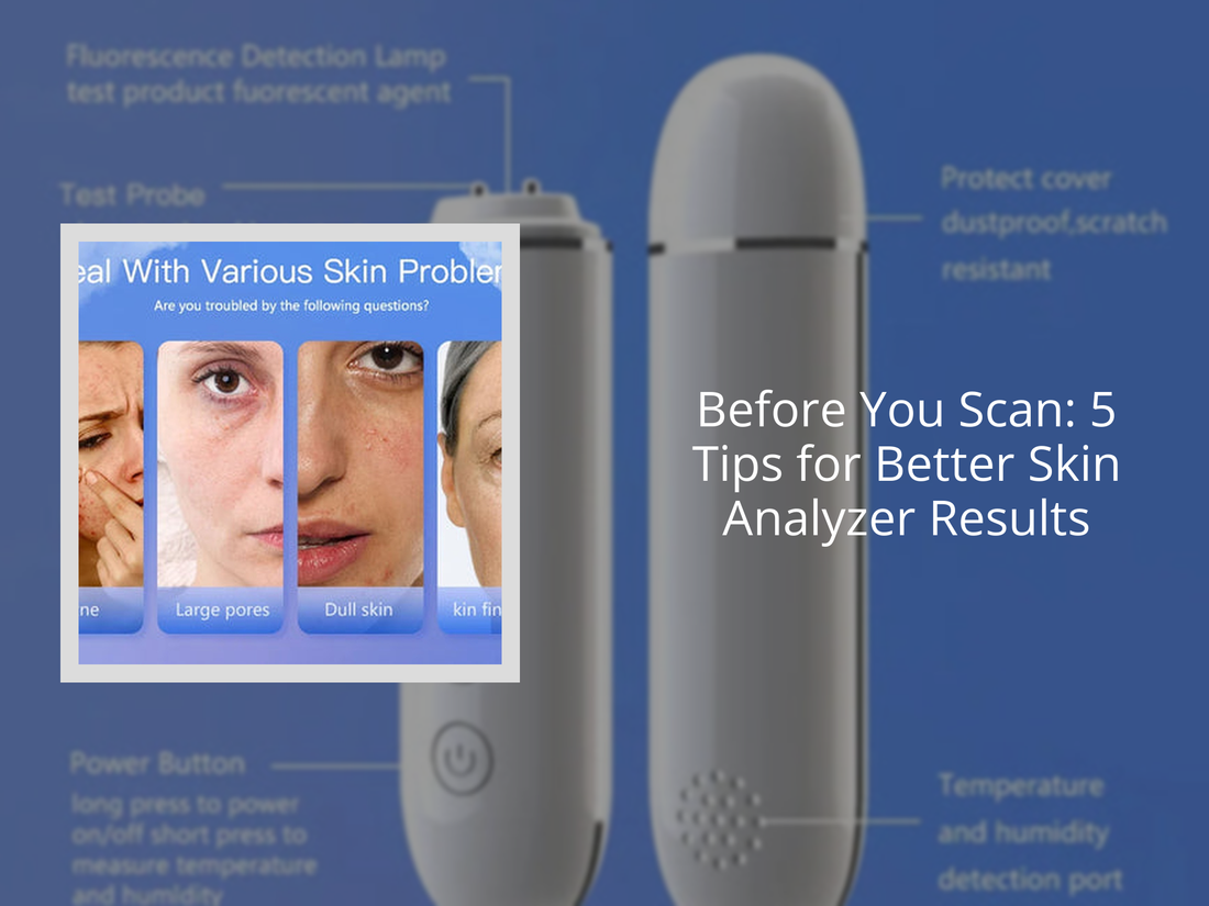 Before You Scan: 5 Tips for Better Skin Analyzer Results